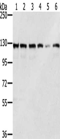 Gel: 6%SDS-PAGE, Lysate: 40 ug, Lane 1-6: Lovo cells, A172 cells, A375 cells, 231 cells, Jurkat cells, hela cells, Primary antibody: CSB-PA870281(RNF20 Antibody) at dilution 1/350, Secondary antibody: Goat anti rabbit IgG at 1/8000 dilution, Exposure time: 5 seconds