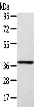 Gel: 8%SDS-PAGE,Lysate: 40 ug, Primary antibody: CSB-PA902433(SIRT4 Antibody) at dilution 1/200 dilution,Secondary antibody: Goat anti rabbit IgG at 1/8000 dilution,Exposure time: 3 minutes