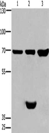 Gel: 6%SDS-PAGE, Lysate: 40 ug, Lane 1-3: Mouse brain tissue, Mouse heart tissue, mouse liver tissue, Primary antibody: CSB-PA904720(CABLES1 Antibody) at dilution 1/350, Secondary antibody: Goat anti rabbit IgG at 1/8000 dilution, Exposure time: 1 minute