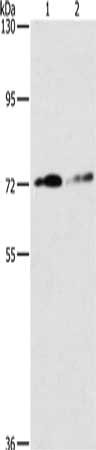 Western Blotting(WB) - ITGB7 Antibody