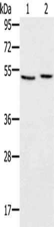 Western Blotting(WB) - SLC39A7 Antibody