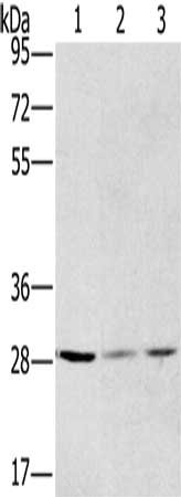 Gel: 8%SDS-PAGE, Lysate: 40 ug, Lane 1-3: A375 cells, hela cells, A172 cells, Primary antibody: CSB-PA950658(HSD17B12 Antibody) at dilution 1/570, Secondary antibody: Goat anti rabbit IgG at 1/8000 dilution, Exposure time: 30 seconds