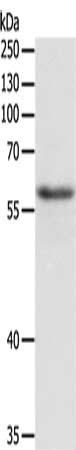 Western Blotting(WB) - TRAF6 Antibody