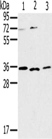 Gel: 10%SDS-PAGE, Lysate: 40 ug, Lane 1-3: SP20 cells, Raji cells, 231 cells, Primary antibody: CSB-PA955318(IL22RA2 Antibody) at dilution 1/200, Secondary antibody: Goat anti rabbit IgG at 1/8000 dilution, Exposure time: 10 minutes