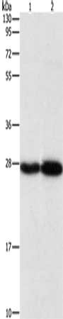 Gel: 10%SDS-PAGE, Lysate: 40 ug, Lane 1-2: Human testis tissue, mouse brain tissue, Primary antibody: CSB-PA955584(PSMB7 Antibody) at dilution 1/310, Secondary antibody: Goat anti rabbit IgG at 1/8000 dilution, Exposure time: 5 seconds