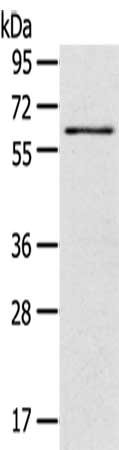 Gel: 8%SDS-PAGE,Lysate: 40 ug, Primary antibody: CSB-PA955877(SIGLEC12 Antibody) at dilution 1/500 dilution,Secondary antibody: Goat anti rabbit IgG at 1/8000 dilution,Exposure time: 30 seconds