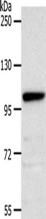 Gel: 8%SDS-PAGE, Lysate: 40ug, Lane: Hela cells, Primary antibody: CSB-PA964902(NOTCH2 Antibody) at dilution 1/450, Secondary antibody: Goat anti rabbit IgG at 1/8000 dilution, Exposure time: 10 minutes