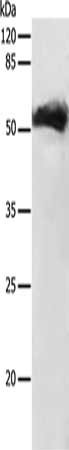Gel: 12%SDS-PAGE, Lysate: 30 ug, Lane: Human ovarian cancer tissue, Primary antibody: CSB-PA971102(GDF9 Antibody) at dilution 1/150, Secondary antibody: Goat anti rabbit IgG at 1/8000 dilution, Exposure time: 5 minutes