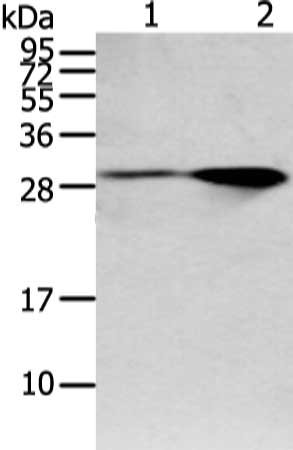 Gel: 12%SDS-PAGE, Lysate: 40 ug, Lane 1-2: Mouse brain and human fetal brain tissue, Primary antibody: CSB-PA976302(SPIN4 Antibody) at dilution 1/200 dilution, Secondary antibody: Goat anti rabbit IgG at 1/8000 dilution, Exposure time: 1 minute