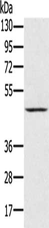 Gel: 8%SDS-PAGE, Lysate: 40 ug, Lane: Human normal kidney tissue, Primary antibody: CSB-PA977660(PRR5 Antibody) at dilution 1/300, Secondary antibody: Goat anti rabbit IgG at 1/8000 dilution, Exposure time: 5 minutes