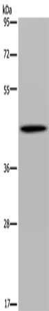 Gel: 8%SDS-PAGE, Lysate: 40 ug, Lane: Human fetal brain tissue, Primary antibody: CSB-PA978301(FADS1 Antibody) at dilution 1/300, Secondary antibody: Goat anti rabbit IgG at 1/8000 dilution, Exposure time: 2 minutes