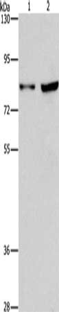 Gel: 6%SDS-PAGE, Lysate: 40 ug, Lane 1-2: Hela cells, Raji cells, Primary antibody: CSB-PA990239(MYB Antibody) at dilution 1/633, Secondary antibody: Goat anti rabbit IgG at 1/8000 dilution, Exposure time: 10 minutes Gel: 6%SDS-PAGE, Lysate: 40 ug, Lane 1-2: Hela cells, Raji cells, Primary antibody: CSB-PA990239(MYB Antibody) at dilution 1/633, Secondary antibody: Goat anti rabbit IgG at 1/8000 dilution, Exposure time: 10 minutes