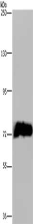 Gel: 6%SDS-PAGE, Lysate: 40 ug, Lane: Mouse kidney tissue, Primary antibody: CSB-PA990282(MAPK8IP1 Antibody) at dilution 1/50, Secondary antibody: Goat anti rabbit IgG at 1/8000 dilution, Exposure time: 5 minutes Gel: 6%SDS-PAGE, Lysate: 40 ug, Lane: Mouse kidney tissue, Primary antibody: CSB-PA990282(MAPK8IP1 Antibody) at dilution 1/50, Secondary antibody: Goat anti rabbit IgG at 1/8000 dilution, Exposure time: 5 minutes