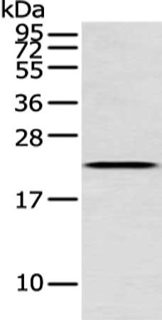 Gel: 12%SDS-PAGE, Lysate: 40ug, Lane: Human fetal liver tissue, Primary antibody: CSB-PA995781(IFNG Antibody) at dilution 1/250 dilution, Secondary antibody: Goat anti rabbit IgG at 1/8000 dilution, Exposure time: 1 minute