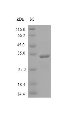 Recombinant Human SPARC protein (SPARC), partial (Active) Recombinant Human SPARC protein (SPARC), partial (Active)