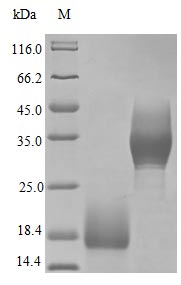 Recombinant Human Trefoil factor 3 protein (TFF3) (Active) Recombinant Human Trefoil factor 3 protein (TFF3) (Active)