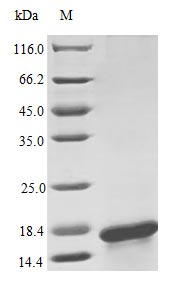CSB-AP001841HU SDS-page