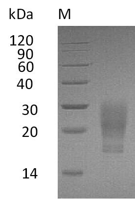 Recombinant Human Granulocyte-macrophage colony-stimulating factor (CSF2) (Active) - image 1