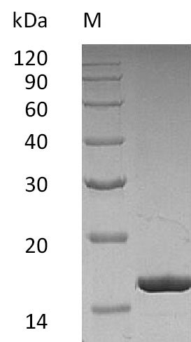 (Tris-Glycine gel) Discontinuous SDS-PAGE (reduced) with 5% enrichment gel and 15% separation gel. (Tris-Glycine gel) Discontinuous SDS-PAGE (reduced) with 5% enrichment gel and 15% separation gel.
