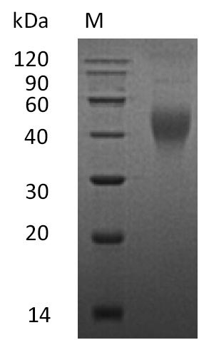 (Tris-Glycine gel) Discontinuous SDS-PAGE (reduced) with 5% enrichment gel and 15% separation gel. (Tris-Glycine gel) Discontinuous SDS-PAGE (reduced) with 5% enrichment gel and 15% separation gel.