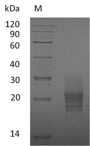 Recombinant Mouse Granulocyte-macrophage colony-stimulating factor (Csf2) (Active) - image 1