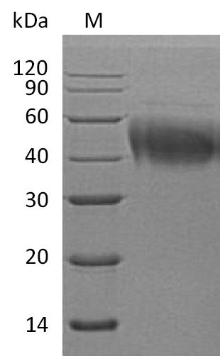 Recombinant Human Interleukin-4 receptor subunit alpha (IL4R) , partial (Active) - image 1