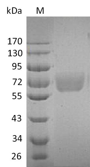 (Tris-Glycine gel) Discontinuous SDS-PAGE (reduced) with 5% enrichment gel and 15% separation gel. (Tris-Glycine gel) Discontinuous SDS-PAGE (reduced) with 5% enrichment gel and 15% separation gel.
