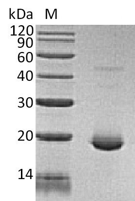 (Tris-Glycine gel) Discontinuous SDS-PAGE (reduced) with 5% enrichment gel and 15% separation gel. (Tris-Glycine gel) Discontinuous SDS-PAGE (reduced) with 5% enrichment gel and 15% separation gel.