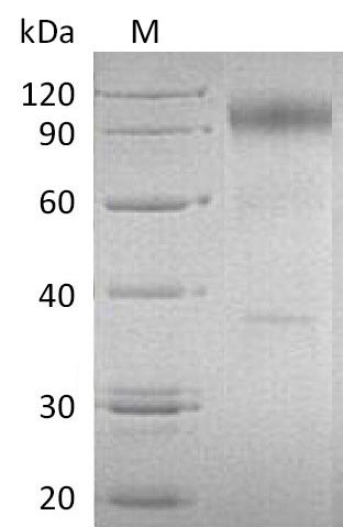 (Tris-Glycine gel) Discontinuous SDS-PAGE (reduced) with 5% enrichment gel and 15% separation gel. (Tris-Glycine gel) Discontinuous SDS-PAGE (reduced) with 5% enrichment gel and 15% separation gel.