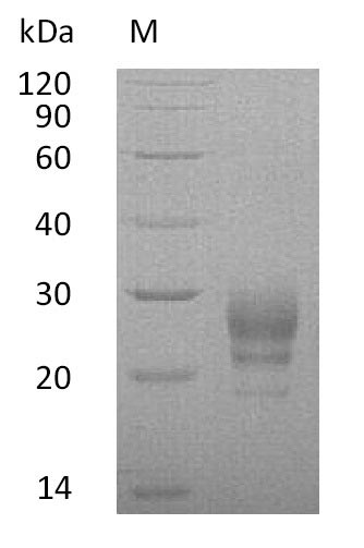 Recombinant Human Interleukin-7 (IL7) (Active) - image 1