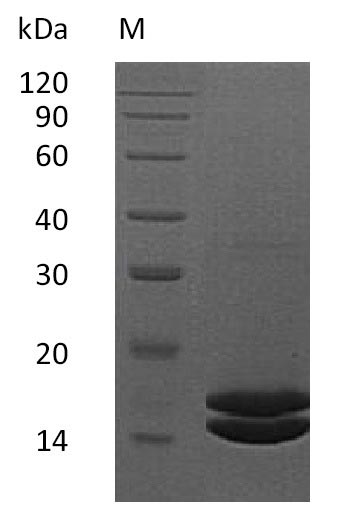 Recombinant Human Interleukin-2 (IL2) (Active) - image 1