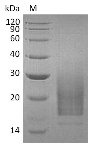 Recombinant Human Interleukin-3 (IL3) (Active) - image 1