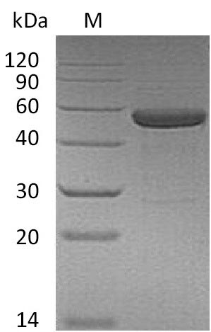(Tris-Glycine gel) Discontinuous SDS-PAGE (reduced) with 5% enrichment gel and 15% separation gel. (Tris-Glycine gel) Discontinuous SDS-PAGE (reduced) with 5% enrichment gel and 15% separation gel.