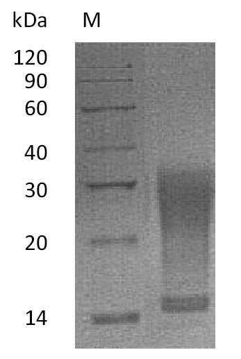 (Tris-Glycine gel) Discontinuous SDS-PAGE (reduced) with 5% enrichment gel and 15% separation gel. (Tris-Glycine gel) Discontinuous SDS-PAGE (reduced) with 5% enrichment gel and 15% separation gel.