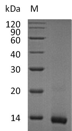 (Tris-Glycine gel) Discontinuous SDS-PAGE (reduced) with 5% enrichment gel and 15% separation gel. (Tris-Glycine gel) Discontinuous SDS-PAGE (reduced) with 5% enrichment gel and 15% separation gel.