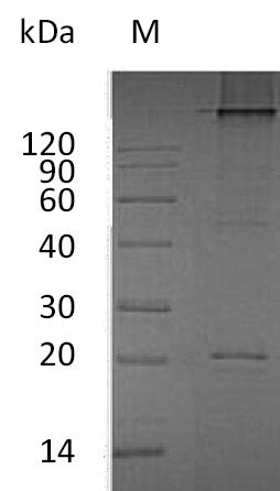 (Tris-Glycine gel) Discontinuous SDS-PAGE (reduced) with 5% enrichment gel and 15% separation gel. (Tris-Glycine gel) Discontinuous SDS-PAGE (reduced) with 5% enrichment gel and 15% separation gel.
