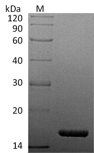 (Tris-Glycine gel) Discontinuous SDS-PAGE (reduced) with 5% enrichment gel and 15% separation gel. (Tris-Glycine gel) Discontinuous SDS-PAGE (reduced) with 5% enrichment gel and 15% separation gel.