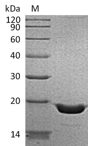 (Tris-Glycine gel) Discontinuous SDS-PAGE (reduced) with 5% enrichment gel and 15% separation gel. (Tris-Glycine gel) Discontinuous SDS-PAGE (reduced) with 5% enrichment gel and 15% separation gel.