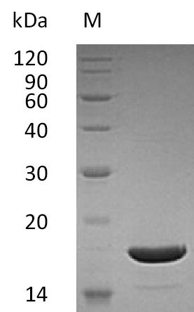 (Tris-Glycine gel) Discontinuous SDS-PAGE (reduced) with 5% enrichment gel and 15% separation gel. (Tris-Glycine gel) Discontinuous SDS-PAGE (reduced) with 5% enrichment gel and 15% separation gel.