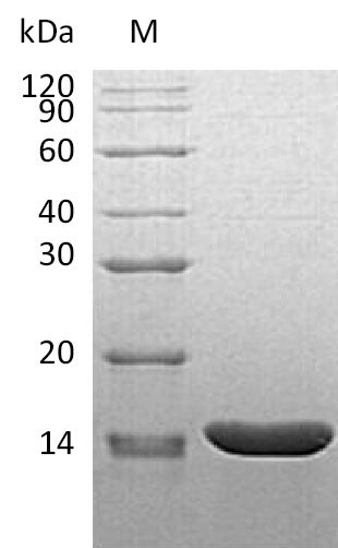 (Tris-Glycine gel) Discontinuous SDS-PAGE (reduced) with 5% enrichment gel and 15% separation gel. (Tris-Glycine gel) Discontinuous SDS-PAGE (reduced) with 5% enrichment gel and 15% separation gel.