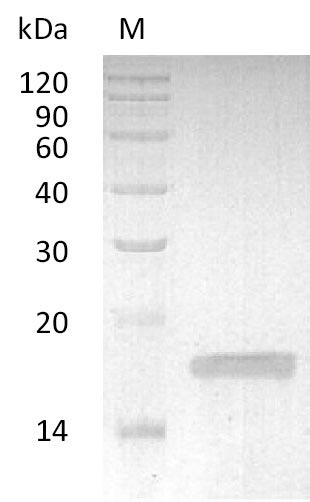 (Tris-Glycine gel) Discontinuous SDS-PAGE (reduced) with 5% enrichment gel and 15% separation gel. (Tris-Glycine gel) Discontinuous SDS-PAGE (reduced) with 5% enrichment gel and 15% separation gel.