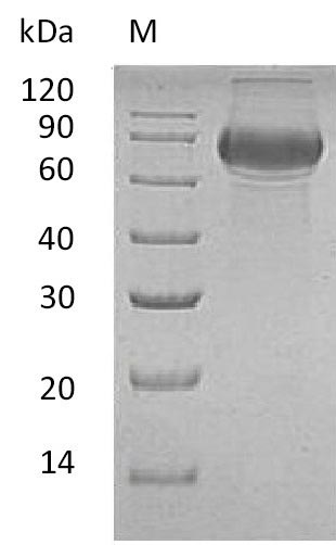 (Tris-Glycine gel) Discontinuous SDS-PAGE (reduced) with 5% enrichment gel and 15% separation gel. (Tris-Glycine gel) Discontinuous SDS-PAGE (reduced) with 5% enrichment gel and 15% separation gel.