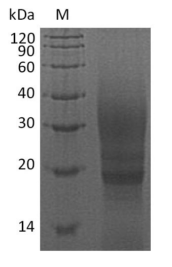 (Tris-Glycine gel) Discontinuous SDS-PAGE (reduced) with 5% enrichment gel and 15% separation gel. (Tris-Glycine gel) Discontinuous SDS-PAGE (reduced) with 5% enrichment gel and 15% separation gel.