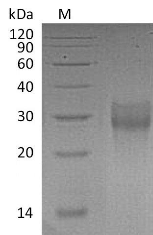 (Tris-Glycine gel) Discontinuous SDS-PAGE (reduced) with 5% enrichment gel and 15% separation gel. (Tris-Glycine gel) Discontinuous SDS-PAGE (reduced) with 5% enrichment gel and 15% separation gel.