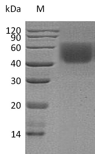(Tris-Glycine gel) Discontinuous SDS-PAGE (reduced) with 5% enrichment gel and 15% separation gel. (Tris-Glycine gel) Discontinuous SDS-PAGE (reduced) with 5% enrichment gel and 15% separation gel.