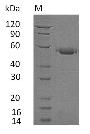 (Tris-Glycine gel) Discontinuous SDS-PAGE (reduced) with 5% enrichment gel and 15% separation gel. (Tris-Glycine gel) Discontinuous SDS-PAGE (reduced) with 5% enrichment gel and 15% separation gel.