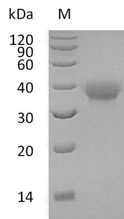 (Tris-Glycine gel) Discontinuous SDS-PAGE (reduced) with 5% enrichment gel and 15% separation gel. (Tris-Glycine gel) Discontinuous SDS-PAGE (reduced) with 5% enrichment gel and 15% separation gel.