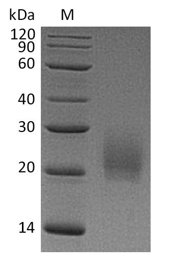 (Tris-Glycine gel) Discontinuous SDS-PAGE (reduced) with 5% enrichment gel and 15% separation gel. (Tris-Glycine gel) Discontinuous SDS-PAGE (reduced) with 5% enrichment gel and 15% separation gel.
