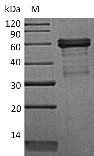 (Tris-Glycine gel) Discontinuous SDS-PAGE (reduced) with 5% enrichment gel and 15% separation gel. (Tris-Glycine gel) Discontinuous SDS-PAGE (reduced) with 5% enrichment gel and 15% separation gel.