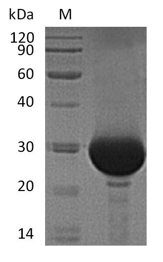 (Tris-Glycine gel) Discontinuous SDS-PAGE (reduced) with 5% enrichment gel and 15% separation gel. (Tris-Glycine gel) Discontinuous SDS-PAGE (reduced) with 5% enrichment gel and 15% separation gel.